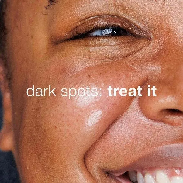 dark spot solutions kit